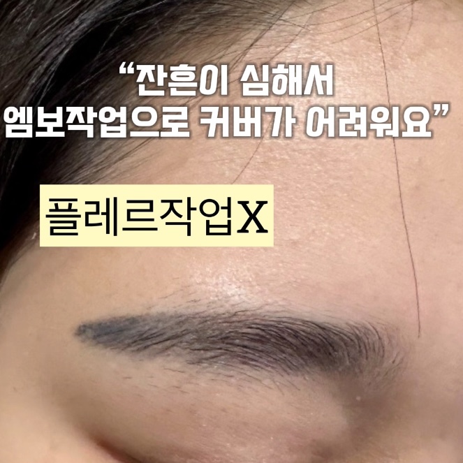 잔흔이 심해서 엠보작업으로 커버가 어려운 케이스 전체 얼굴