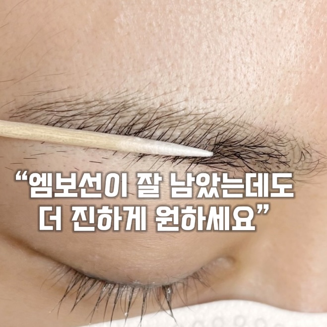 엠보선이 잘 남았는데도 더 진하게 원하는 고객 케이스